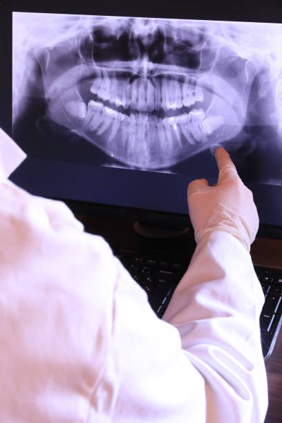 Best Emergency Treatment for Dental Infections or Abscesses in Tallmadge, OH