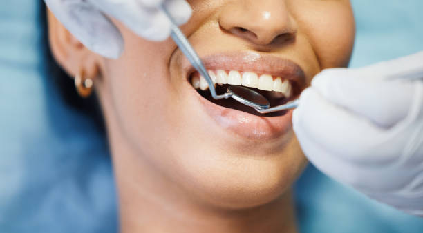 Best Emergency Gum Treatment in Tallmadge, OH