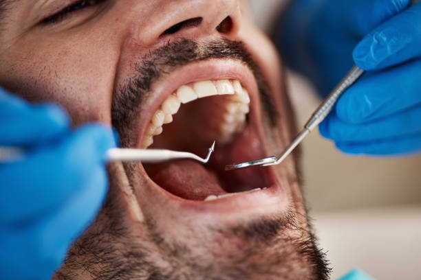 Best Emergency Dental Care for Broken or Chipped Teeth in Tallmadge, OH